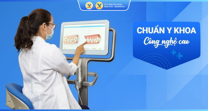 Bảng giá dịch vụ lấy cao răng 